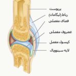 پوکی استخوان و عوامل موثر برآن
